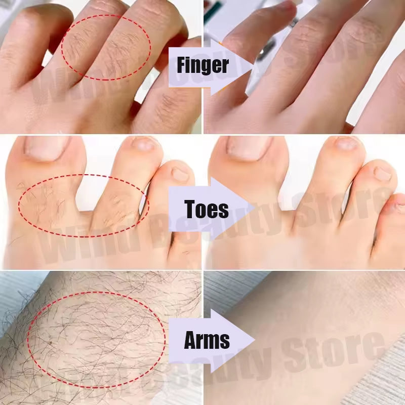 SmoothSilk Painless Hair Removal Cream – Fast, Gentle & Whitening Formula for Lip, Underarm & Sensitive Skin